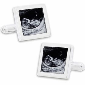 Sonogram Photo Cufflinks